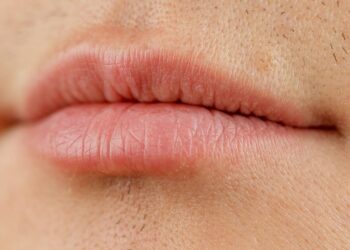 Les femmes ont averti que deux problèmes de santé courants pourraient provoquer des poils sur le visage