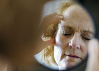 Les médecins suggèrent de supprimer ces aliments favoris pour éviter les migraines